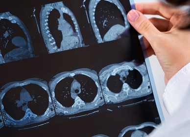A clinitian with CT scans